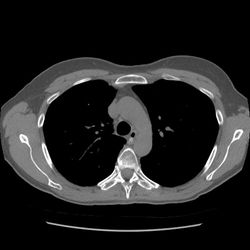 betsy CT scan.jpg